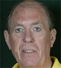 John Lowe | Darts